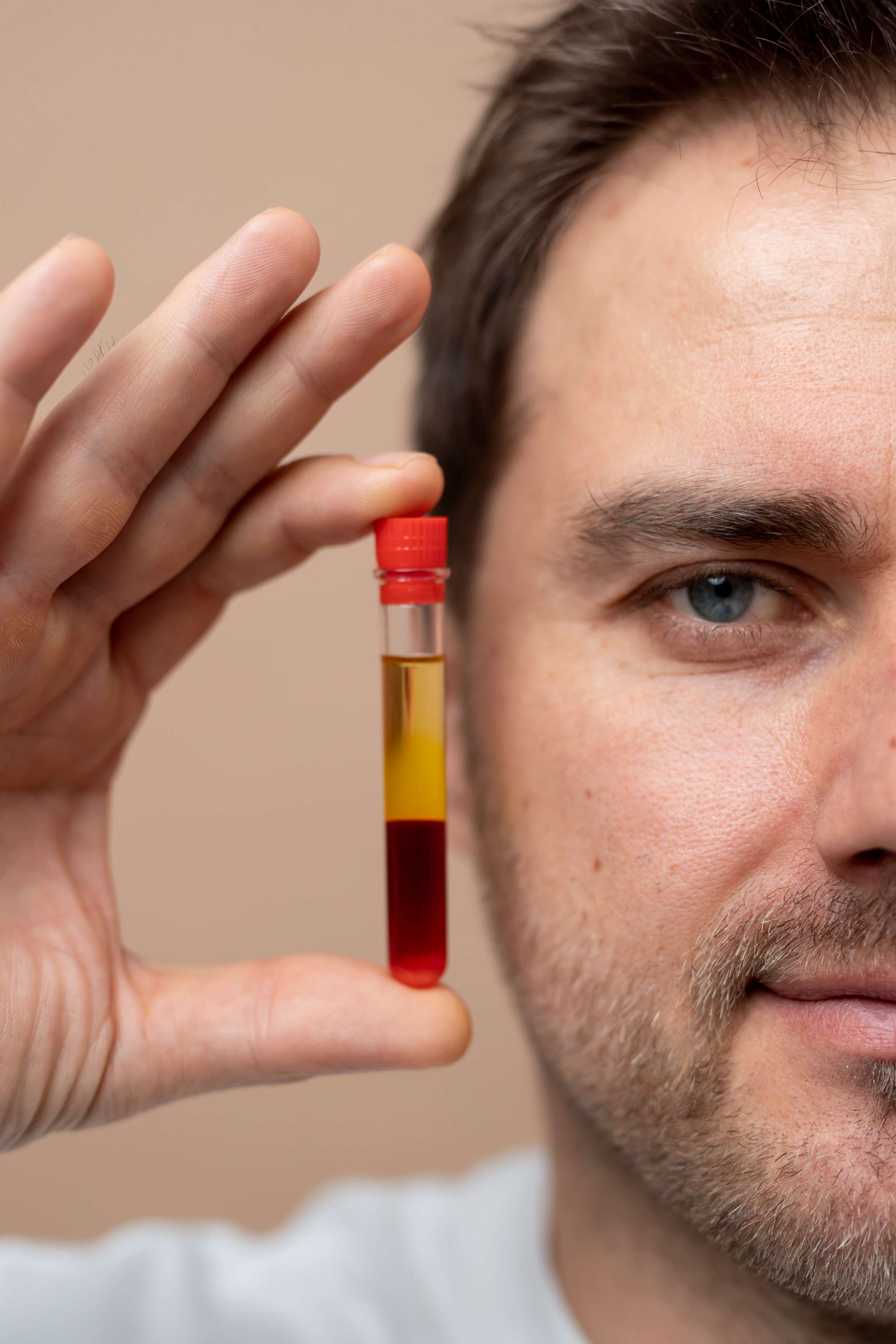 Professional polynucleotide skin rejuvenation treatment